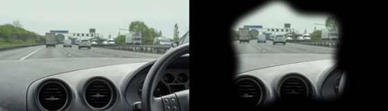 صور صادمة تظهر كيف يبدو العالم لمن يعانون مشكلات في البصر صورة رقم 4