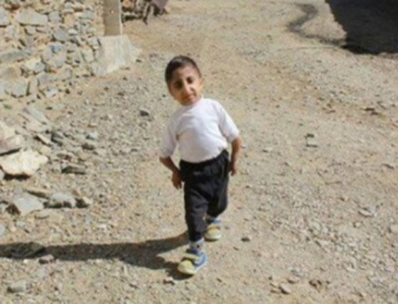 طوله 64.7 سنتيمتر.. شاب إيراني يستعد للقب أقصر رجل في العالم صورة رقم 9 طوله 64.7 سنتيمتر.. شاب إيراني يستعد للقب أقصر رجل في العالم صورة رقم 9