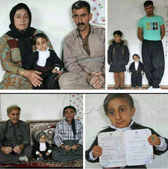 طوله 64.7 سنتيمتر.. شاب إيراني يستعد للقب أقصر رجل في العالم صورة رقم 12 طوله 64.7 سنتيمتر.. شاب إيراني يستعد للقب أقصر رجل في العالم صورة رقم 12