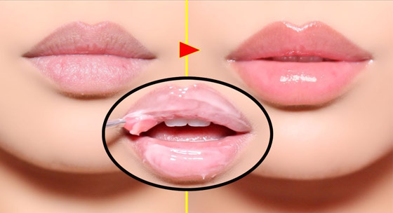 إليكم طرق علاج تشقق الشفاه وجفافها في الشتاء صورة رقم 4 إليكم طرق علاج تشقق الشفاه وجفافها في الشتاء صورة رقم 4