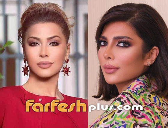 صورة قديمة فضحت عمليات تجميل أصالة ونوال الزغبي! لن تصدق كيف صغرتا مع مر السنين! صورة رقم 7 صورة قديمة فضحت عمليات تجميل أصالة ونوال الزغبي! لن تصدق كيف صغرتا مع مر السنين! صورة رقم 7
