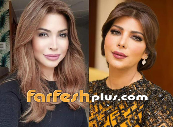 صورة قديمة فضحت عمليات تجميل أصالة ونوال الزغبي! لن تصدق كيف صغرتا مع مر السنين! صورة رقم 2 صورة قديمة فضحت عمليات تجميل أصالة ونوال الزغبي! لن تصدق كيف صغرتا مع مر السنين! صورة رقم 2