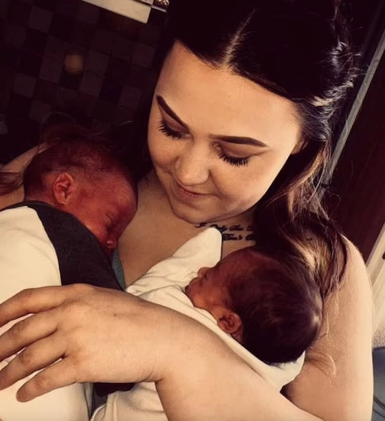 طفلتان توأم تولدان بلونين مختلفين وتنموان في رحمين منفصلين صورة رقم 3