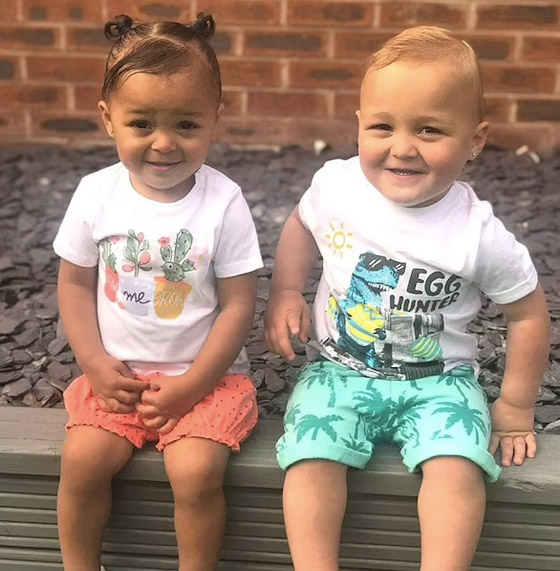 طفلتان توأم تولدان بلونين مختلفين وتنموان في رحمين منفصلين صورة رقم 5