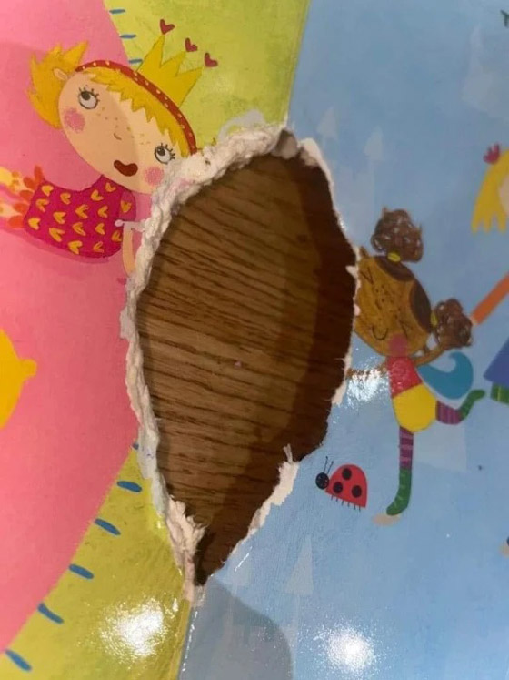 طفلة تأكل الجدران والأثاث بسبب حالة نادرة صورة رقم 3