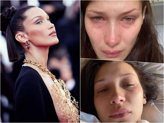 الوجه الباكي.. أحدث صيحات المكياج في 2022 صورة رقم 5