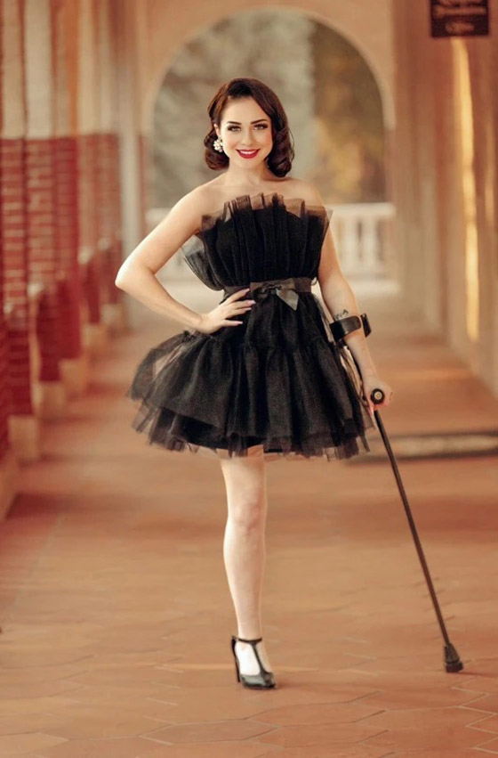 تصبح عارضة أزياء بعدما فقدت ساقها بسبب السرطان صورة رقم 3