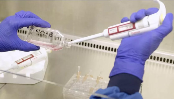 لأول مرة في التاريخ.. حقن خلايا دم أُنتجت مخبريا بجسم شخص صورة رقم 9 لأول مرة في التاريخ.. حقن خلايا دم أُنتجت مخبريا بجسم شخص صورة رقم 9