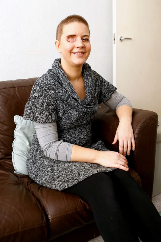 تصبح أول شخص يتم تشريح جسده على الهواء بعدما توفيت بالسرطان صورة رقم 2