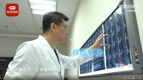 تكتشف أنها مصابة بمرض خطير بسبب كتلة شعر في ظهرها صورة رقم 1