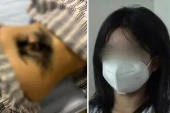 تكتشف أنها مصابة بمرض خطير بسبب كتلة شعر في ظهرها صورة رقم 4