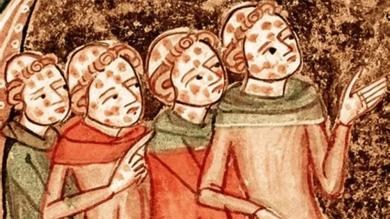 بالقرون الوسطى.. عذبت فرنسا وأحرقت المصابين بهذا المرض صورة رقم 1 بالقرون الوسطى.. عذبت فرنسا وأحرقت المصابين بهذا المرض صورة رقم 1