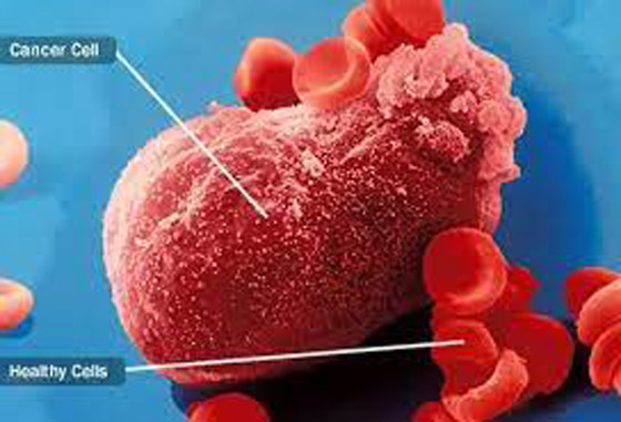 يفارق الحياة بعد منحه كلية سرطانية بالخطأ صورة رقم 2