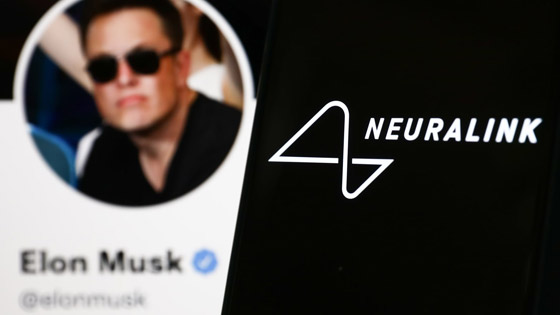 إيلون ماسك: بدء زرع رقاقة لاسلكية بدماغ الإنسان خلال 6 أشهر صورة رقم 3