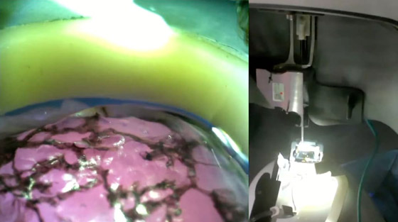 إيلون ماسك: بدء زرع رقاقة لاسلكية بدماغ الإنسان خلال 6 أشهر صورة رقم 6