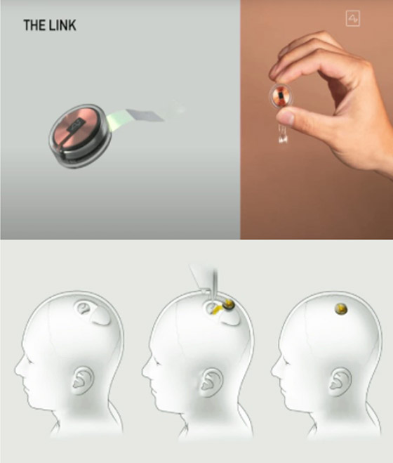 إيلون ماسك: بدء زرع رقاقة لاسلكية بدماغ الإنسان خلال 6 أشهر صورة رقم 2