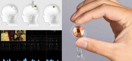 إيلون ماسك: بدء زرع رقاقة لاسلكية بدماغ الإنسان خلال 6 أشهر صورة رقم 7