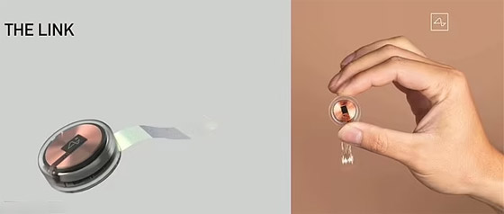 إيلون ماسك: بدء زرع رقاقة لاسلكية بدماغ الإنسان خلال 6 أشهر صورة رقم 10