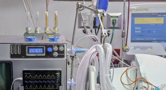 ألمانية متهمة بالقتل العمد.. نزعت جهاز التنفس عن جارتها بالمستشفى لأن صوته أزعجها صورة رقم 2 ألمانية متهمة بالقتل العمد.. نزعت جهاز التنفس عن جارتها بالمستشفى لأن صوته أزعجها صورة رقم 2