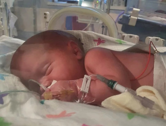 ! طفل يولد مرتين بسبب حالة نادرة صورة رقم 6