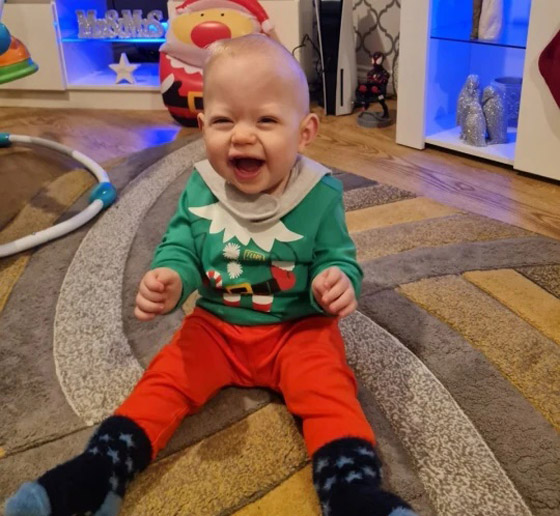 ! طفل يولد مرتين بسبب حالة نادرة صورة رقم 3