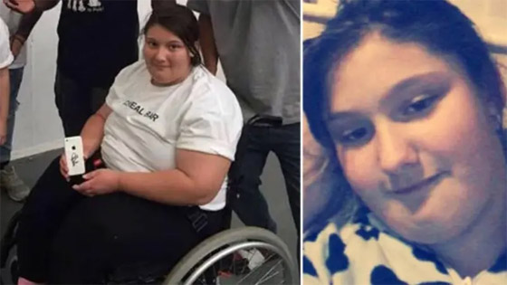 وفاة مراهقة بريطانية بالسمنة.. والمحكمة تتهم والديها بالقتل صورة رقم 1 وفاة مراهقة بريطانية بالسمنة.. والمحكمة تتهم والديها بالقتل صورة رقم 1