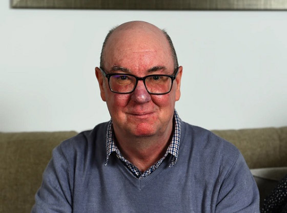 تخليص اسكتلندي من أنفه الضخم بالليزر صورة رقم 2