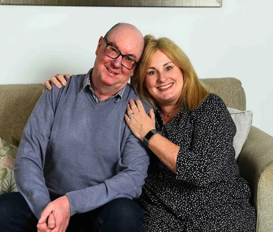 تخليص اسكتلندي من أنفه الضخم بالليزر صورة رقم 3