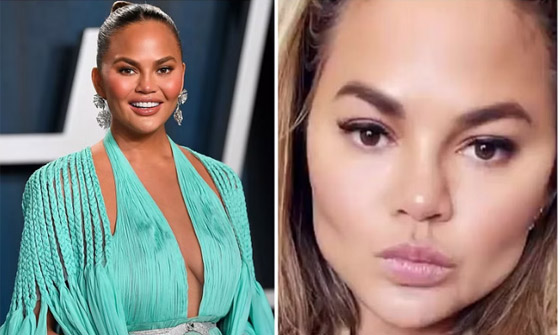 إزالة دهون الخدين آخر ترندات 