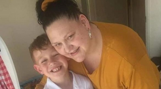 لدغة بعوضة كادت تبتر رجليها صورة رقم 1