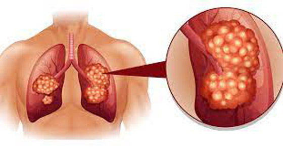 عيادة طبية تخطر مرضاها بأنهم مصابون بالسرطان بدلا من تهنئتهم بالكريسماس صورة رقم 4