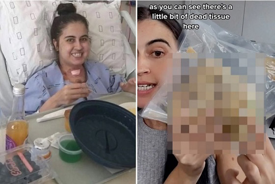 نيوزيلاندية تحتفظ بقلبها بعد عملية زرع صورة رقم 2