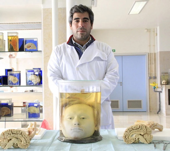 كيف حفظ العلماء رأس أحد أسوأ القتلة المتسلسلين في أوروبا؟ صورة رقم 3