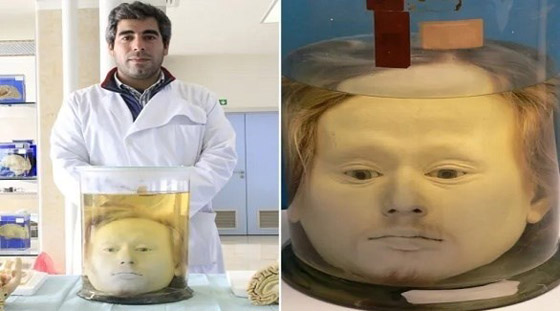 كيف حفظ العلماء رأس أحد أسوأ القتلة المتسلسلين في أوروبا؟ صورة رقم 1