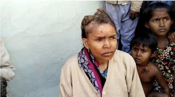 تحير الأطباء بـ 