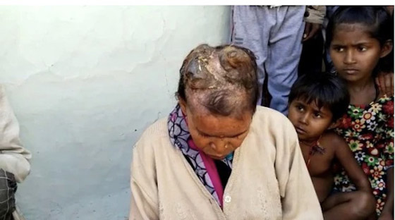 تحير الأطباء بـ 