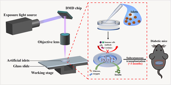 لا حاجة للحقن اليومية.. علاج مبتكر تحت الجلد لمرضى السكري صورة رقم 3 لا حاجة للحقن اليومية.. علاج مبتكر تحت الجلد لمرضى السكري صورة رقم 3