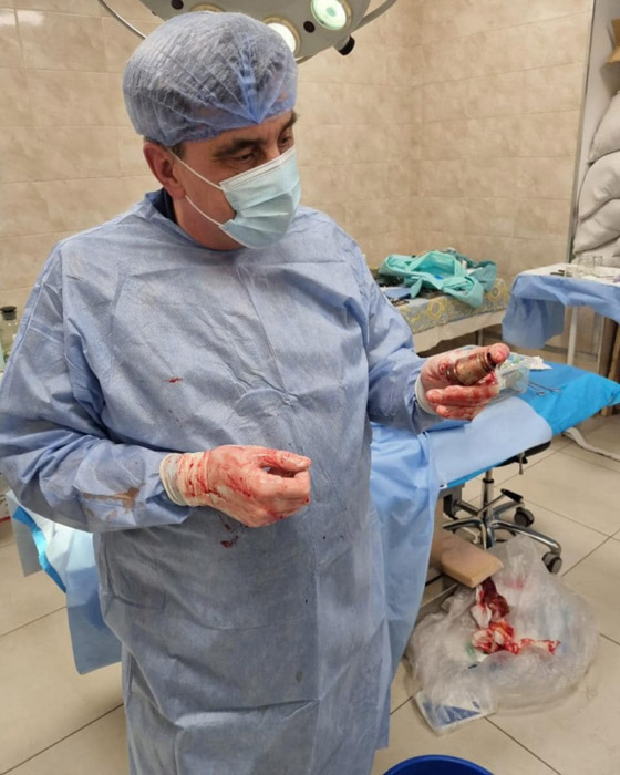 معجزة طبية.. نجاح عملية استئصال قنبلة من جسم جندي أوكراني صورة رقم 3 معجزة طبية.. نجاح عملية استئصال قنبلة من جسم جندي أوكراني صورة رقم 3