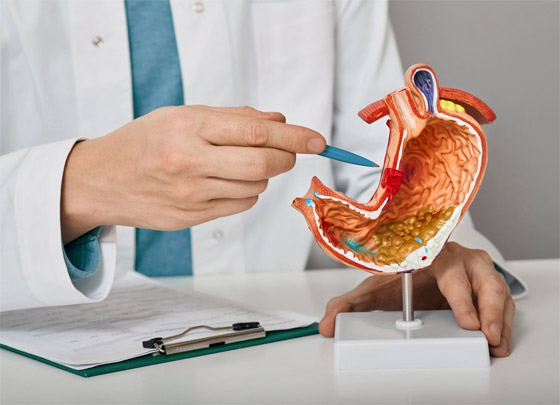 من بينها العرقسوس.. 5 مشروبات لعلاج قرحة المعدة وتلطيف الألم صورة رقم 9 من بينها العرقسوس.. 5 مشروبات لعلاج قرحة المعدة وتلطيف الألم صورة رقم 9