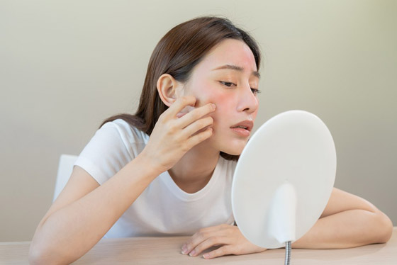 طرق لعلاج انسداد المسام.. شتاءً صورة رقم 4