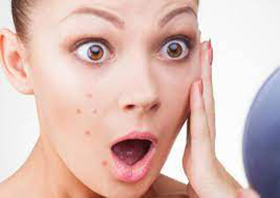 طرق لعلاج انسداد المسام.. شتاءً صورة رقم 6