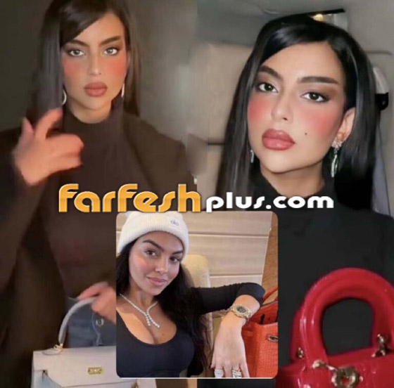 صور: شبيهة جورجينا رودريغز السعودية توضح الخضوع للتجميل لتقليد شريكة رونالدو! صورة رقم 3 صور: شبيهة جورجينا رودريغز السعودية توضح الخضوع للتجميل لتقليد شريكة رونالدو! صورة رقم 3