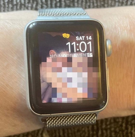ساعة آبل تكشف إصابة سيدة بمرض خطير وتنقذها من الموت صورة رقم 2