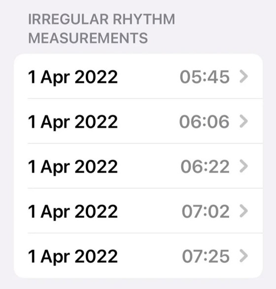 ساعة آبل تكشف إصابة سيدة بمرض خطير وتنقذها من الموت صورة رقم 3