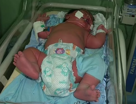 أضخم مولود في العالم! امرأة برازيلية تُنجب طفلا بوزن أضخم مولود في العالم! امرأة برازيلية تُنجب طفلا بوزن