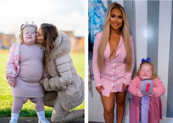 تمنع طفلتها من دخول المطبخ بسبب حالة نادرة صورة رقم 1