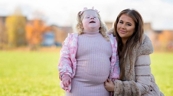 تمنع طفلتها من دخول المطبخ بسبب حالة نادرة صورة رقم 3