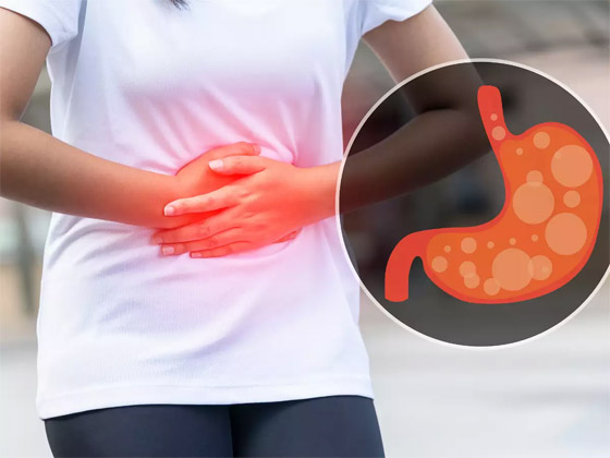 مشكلة مزعجة.. كل ما تريد معرفته عن أسباب وطرق علاج انتفاخ البطن صورة رقم 5