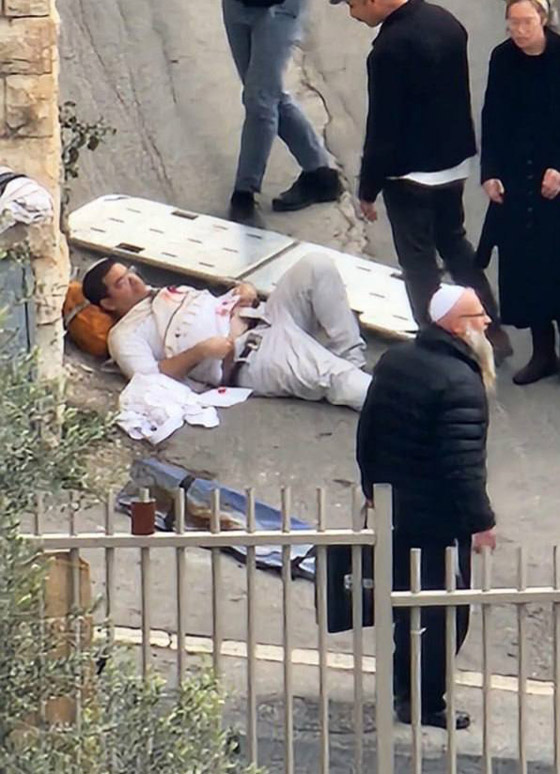 فلسطيني في الـ13 من عمره يصيب مستوطنين بعملية إطلاق نار في القدس صورة رقم 4 فلسطيني في الـ13 من عمره يصيب مستوطنين بعملية إطلاق نار في القدس صورة رقم 4