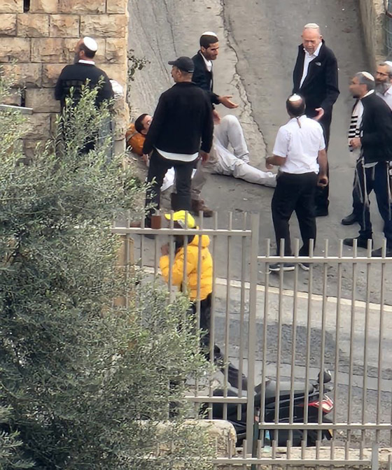 فلسطيني في الـ13 من عمره يصيب مستوطنين بعملية إطلاق نار في القدس صورة رقم 6 فلسطيني في الـ13 من عمره يصيب مستوطنين بعملية إطلاق نار في القدس صورة رقم 6